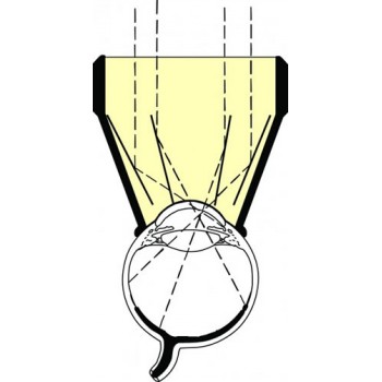 Ocular Mainster PRP 165